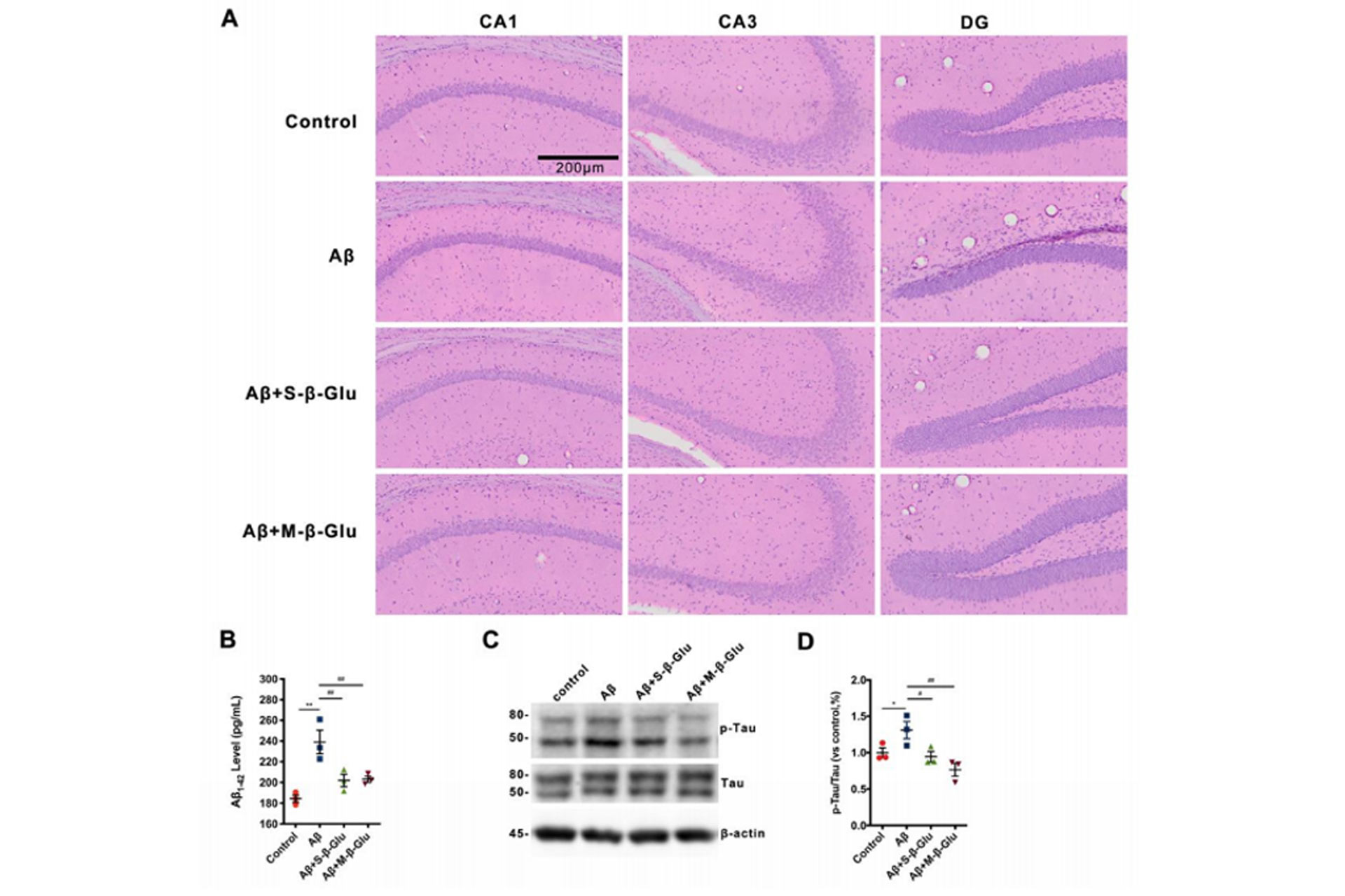 (A)-H&E-staining-of-the-mouse-hippocampus,-and-(B)-(C)-(D)-WB-analysis-of-tau-and-p-tau-proteins-and-their-significant-differences.jpg